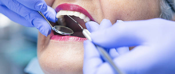 Best Emergency Tooth Extraction in Gilmer, TX